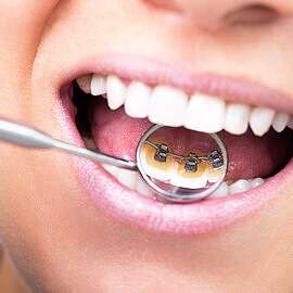 Fogszabályozás Budapest szívében