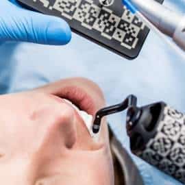 Nobel Biocare Implantátumok